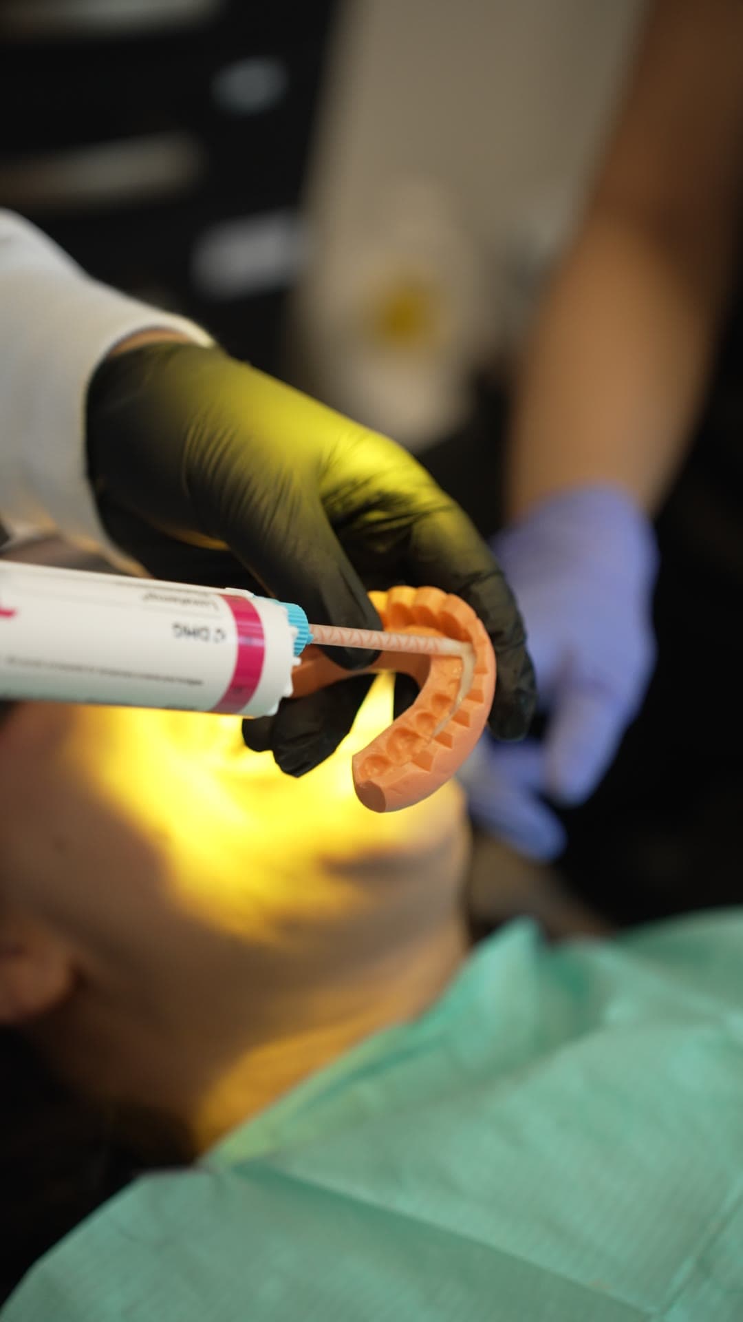 Préparation : empreinte prise en bouche